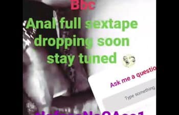 Fat anal Fat anal