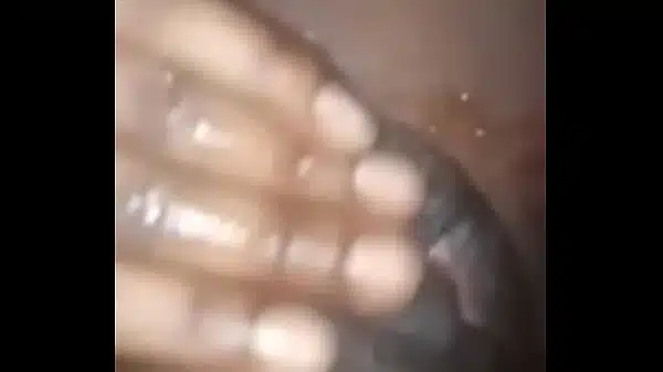 Trans clitóris